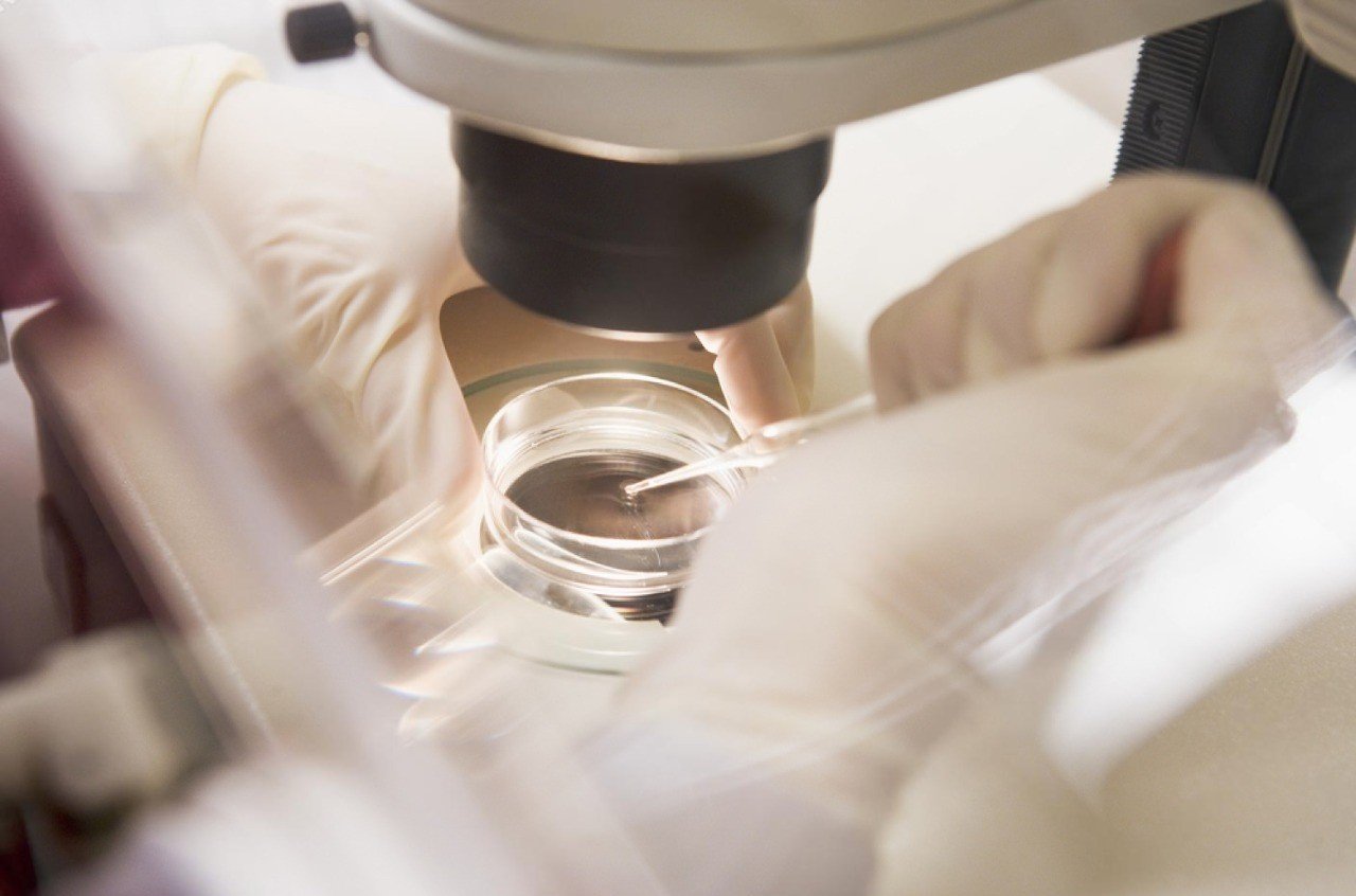 Azoospermia Treatment in Lahore – Modern Solutions for Male Infertility